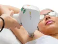 Depilacja laserowa: Bezpieczna? Mity, fakty i jak uniknąć ryzyka