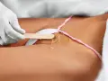 Depilacja intymna przed pierwszym razem? Twój komfort jest kluczem!