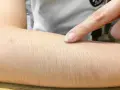 Golenie rąk: Fakty, mity i bezpieczne metody. Warto?