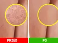 Jak pożegnać „truskawkowe nogi”? Gładka skóra po goleniu!