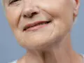 Zbliżenie na twarz starszej kobiety z widocznymi zmarszczkami króliczymi wokół ust i nosa.