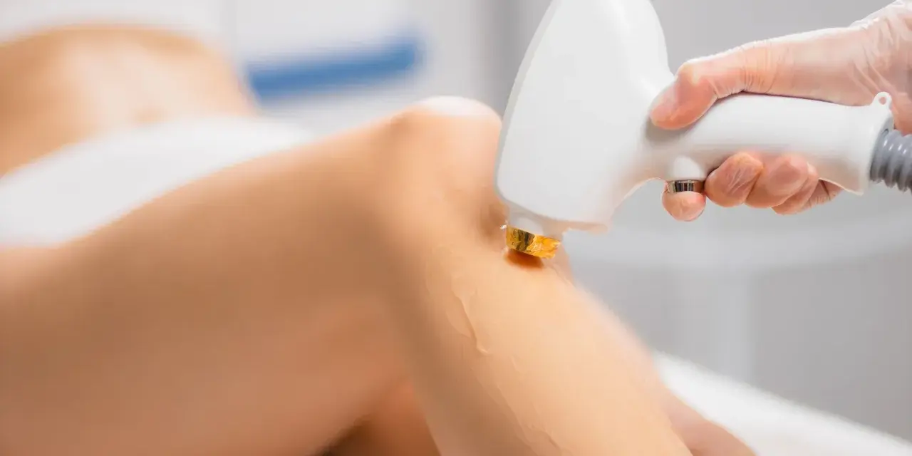 Depilacja laserowa nóg: Ile zabiegów dla gładkiej skóry na lata?