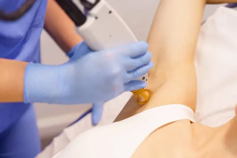 Czy depilacja laserowa boli? Mniej niż myślisz! Porównanie i porady