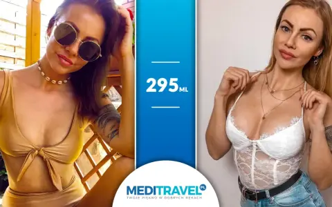 Kobiety prezentujące efekt powiększenia piersi implantami 295 ml. Dwie kobiety w strojach kąpielowych i bieliźnie, podkreślające swoje nowe kształty.