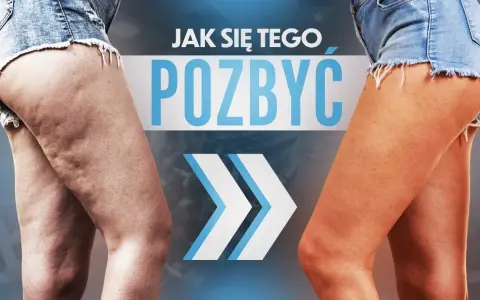 Cellulit na nogach: jak się go pozbyć? Kompleksowy poradnik