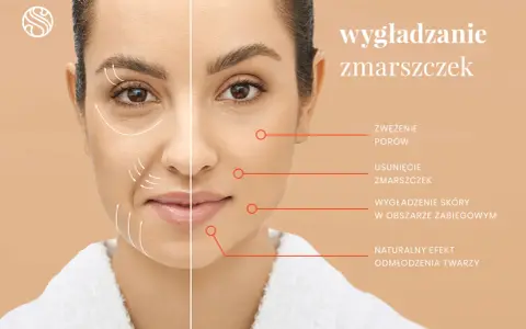 Kobieta przed i po zabiegu wygładzania zmarszczek. Strzałki pokazują poprawę skóry, redukcję zmarszczek i odmłodzenie.