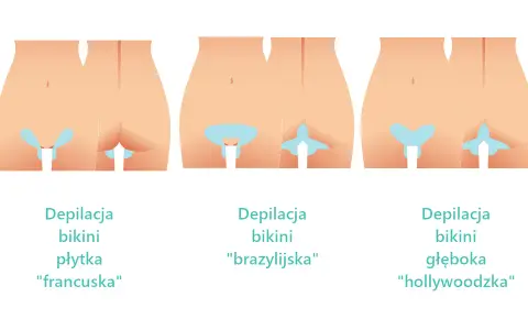 Jak golić miejsca intymne bez wrastających włosków i krostek?