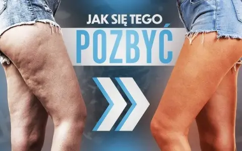 Jak pozbyłam się cellulitu? Mój kompleksowy plan krok po kroku