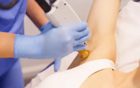 Czy depilacja laserowa boli? Mniej niż myślisz! Porównanie i porady