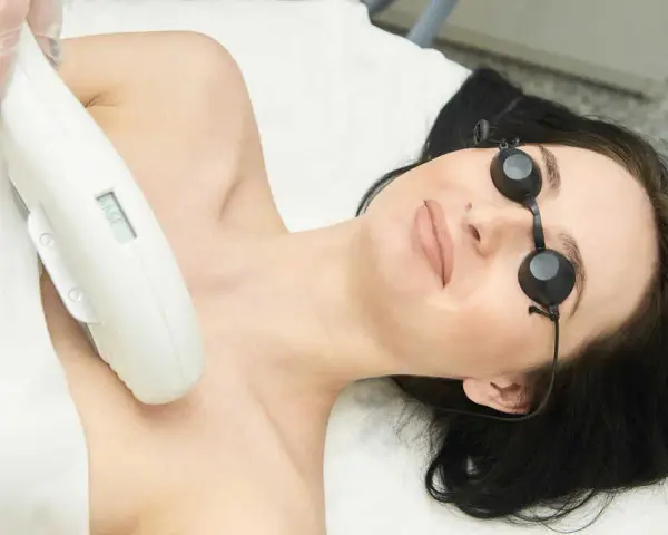 Depilacja laserowa twarzy: Ile zabiegów naprawdę potrzebujesz?