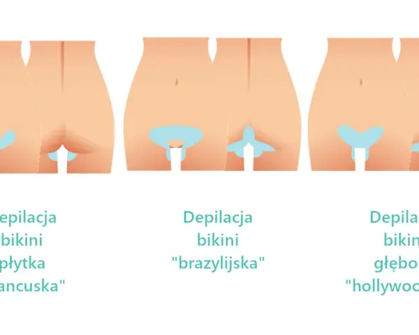 Jak golić miejsca intymne bez wrastających włosków i krostek?