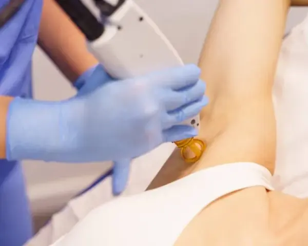 Czy depilacja laserowa boli? Mniej niż myślisz! Porównanie i porady