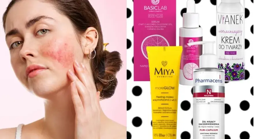 Peeling do cery naczynkowej: bezpieczne złuszczanie i wzmocnienie skóry