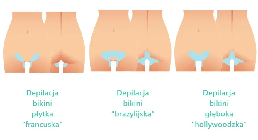 Jak golić miejsca intymne bez wrastających włosków i krostek?