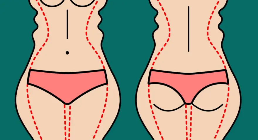 Ilustracja pokazuje sylwetkę przed i po zabiegu liposukcji ud. Czerwone linie zaznaczają obszary do modelowania.
