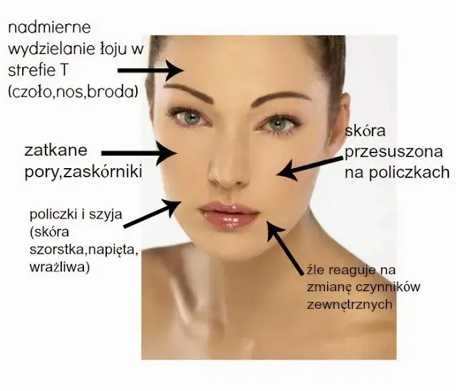 cera mieszana strefa T i policzki