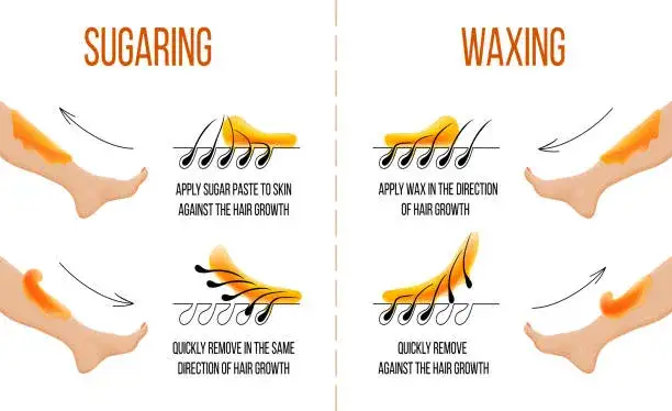 depilacja woskiem vs pasta cukrowa infografika