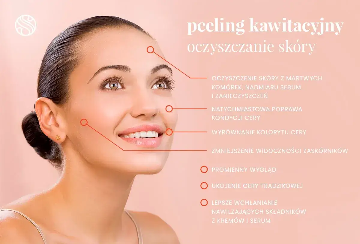 Uśmiechnięta kobieta z gładką cerą, której peeling kawitacyjny usuwa martwy naskórek, sebum i zanieczyszczenia.