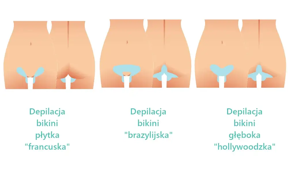 alternatywne metody depilacji miejsc intymnych